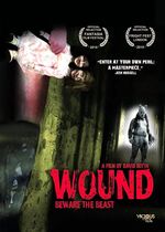 Wound